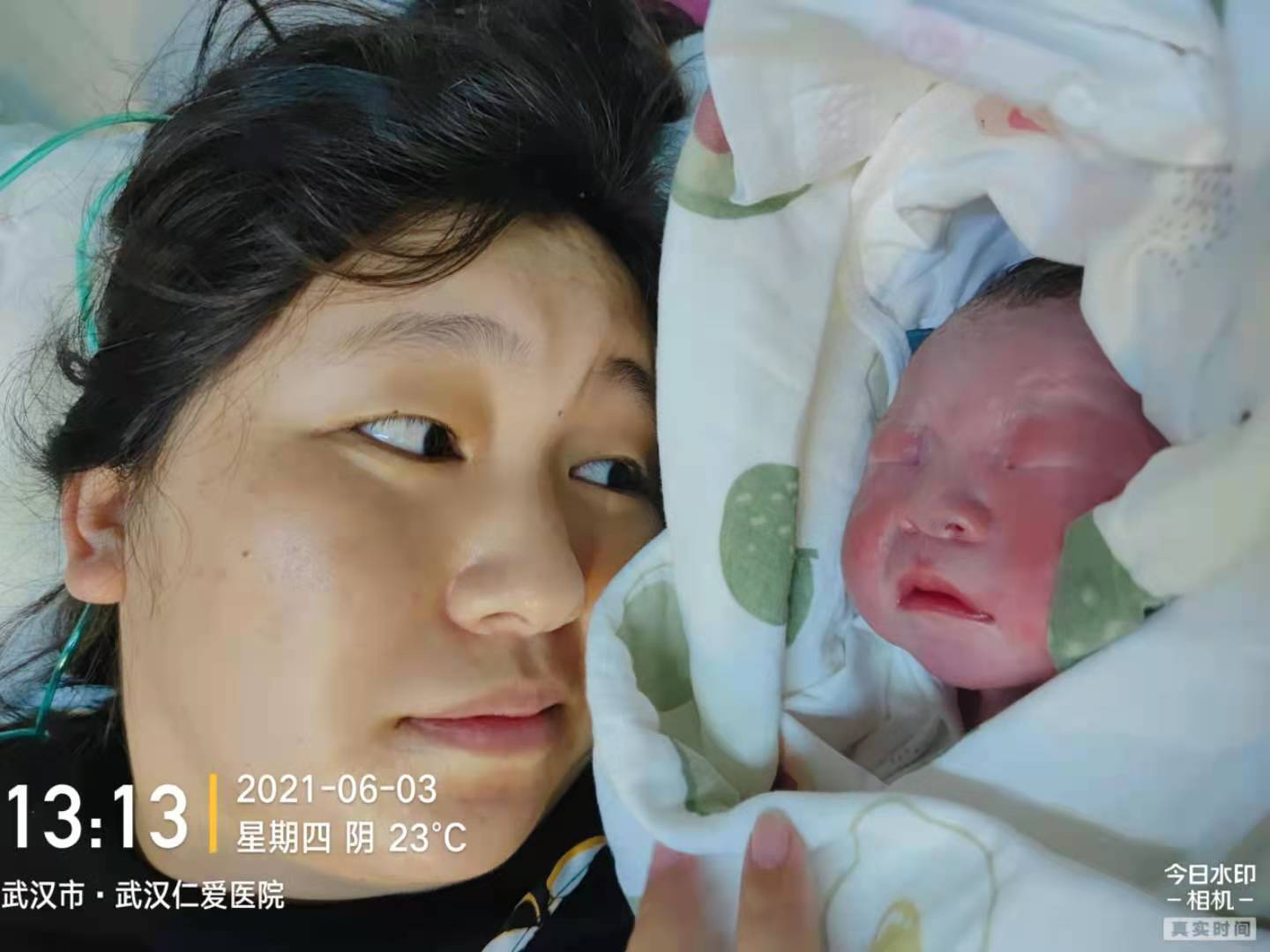 瘢痕子宮順產(chǎn)，圓媽媽順產(chǎn)夢